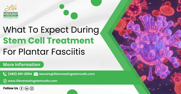 What To Expect During Stem Cell Treatment For Plantar Fasciitis