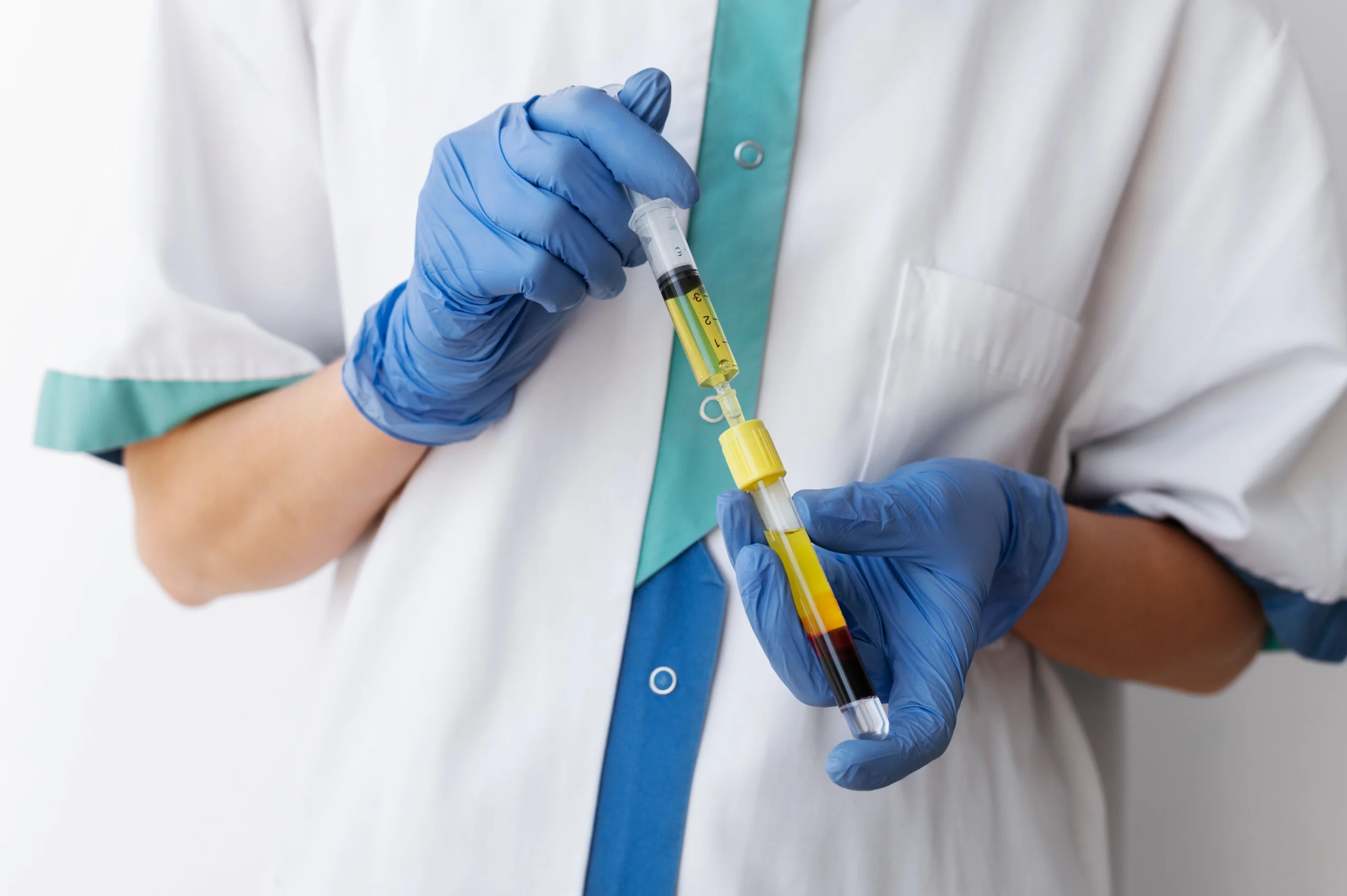 Healthcare professional preparing a stem cell therapy injection in a clinical setting